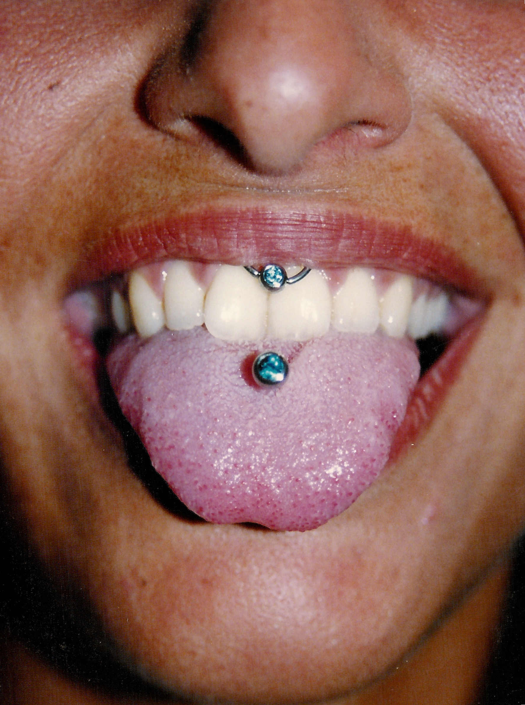 Piercing; Lippenbändchen; Zunge