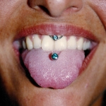 Piercing; Lippenbändchen; Zunge